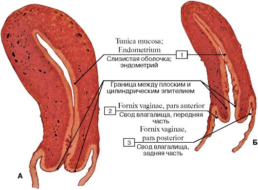 Физиологические изменения положения матки. - student2.ru