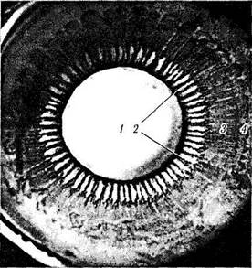 Глава 3. СТРОЕНИЕ ГЛАЗНОГО ЯБЛОКА. Рис. 3.8.29.Топографические особенности ресничного тела: - student2.ru