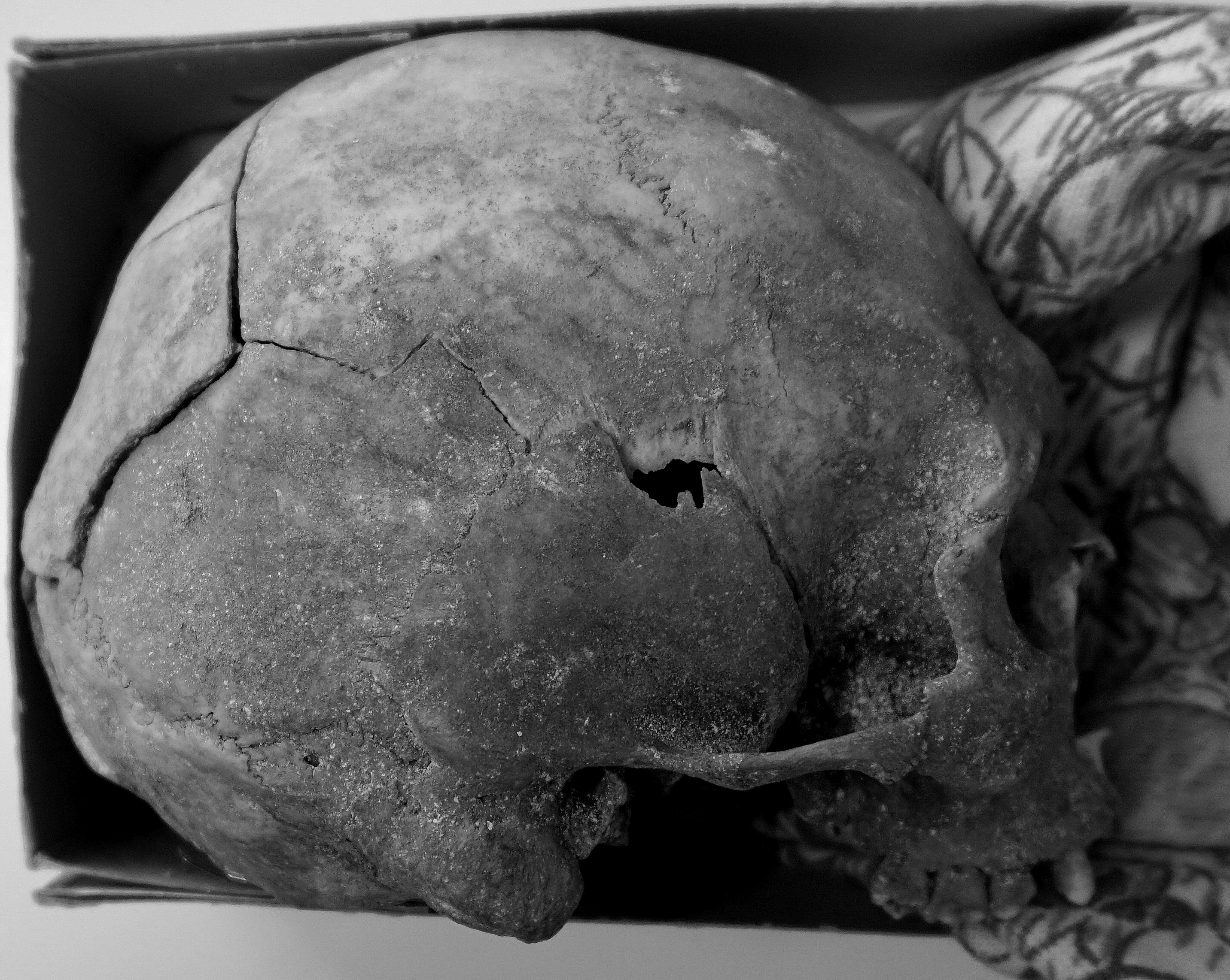 Таким образом, кости из захоронения «2014А-БгК-Р3/1» принадлежали мужчине, биологический возраст которого на момент смерти составлял 22-25 лет, а рост – 174,7 – 177, 5 см. - student2.ru