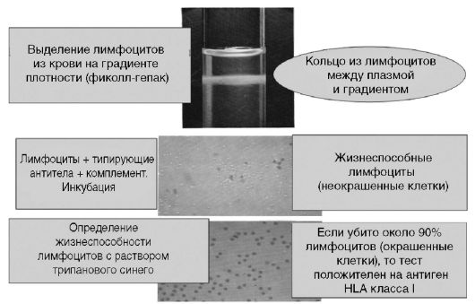 Комплементзависимая цитотоксичность - student2.ru