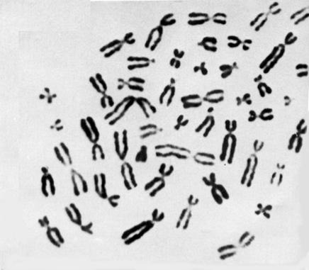 Кратка характеристика хромосом - student2.ru