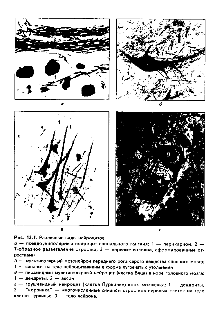 нервная ткань. нейроциты и нейроглия. нервные волокна - student2.ru