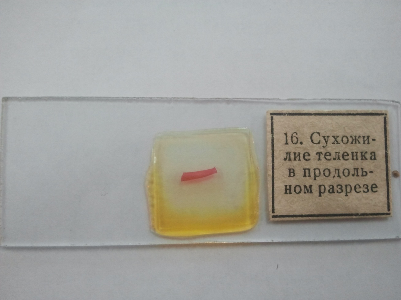 Нейтрофильный лейкоцит - student2.ru