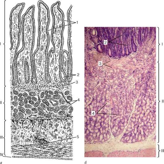 Однослойный столбчатый эпителий; 2 - лимфоидные узелки; 3 - выпячивание - student2.ru