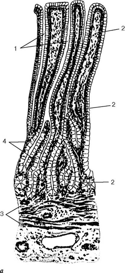 Однослойный столбчатый эпителий; 2 - лимфоидные узелки; 3 - выпячивание - student2.ru