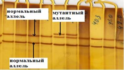 олиморфизма однонитевой днк (sscp-анализ) - student2.ru