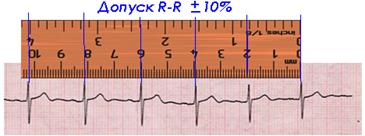 Описание установки и метода измерений. Важным моментом в анализе ЭКГ является расчет длительности указанных промежутков и - student2.ru