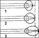 Основные нарушения в работе оптической системы глаза. - student2.ru