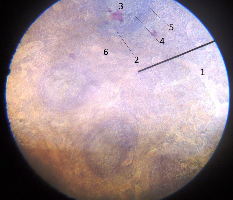 Препарат № 56. Лимфатический узел - student2.ru