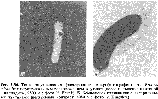 Производные микробной клетки. Исследование подвижности микробов. - student2.ru