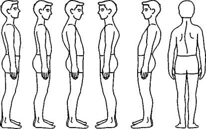 прямой позвоночник во фронтальной плоскости - student2.ru
