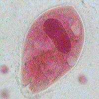 Работа 16.4. Дизентерийная амеба (Entamoeba histolyica) - student2.ru