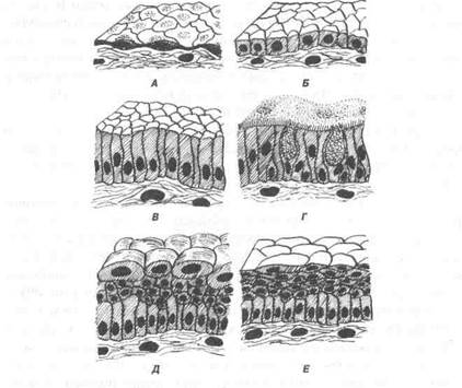Схема 1. Морфологічна класифікація епітеліїв - student2.ru