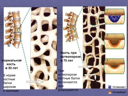 Стан кісткової тканини зараз вважається одним із маркерів, що характеризує загальний стан здоров’я дитини - student2.ru