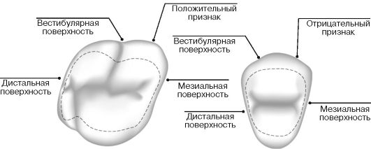 Углубления задней стенки брюшинной полости и таза мужчины. 1 страница - student2.ru