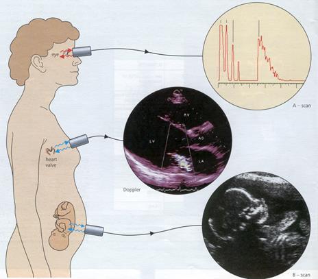 ультразвуковая диагностика - student2.ru