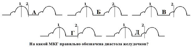 Что характеризует систолический объем сердца? - student2.ru