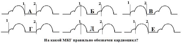 Что характеризует систолический объем сердца? - student2.ru