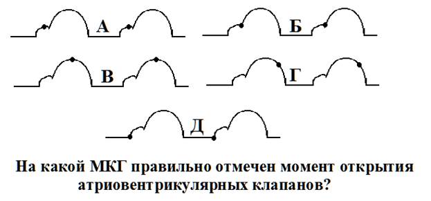 Что характеризует систолический объем сердца? - student2.ru