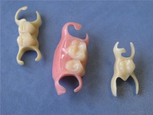 Какие виды несъемных зубных протезов бывают? - student2.ru