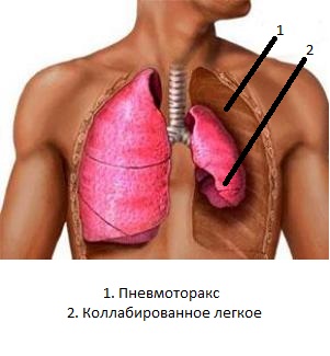 Симптоматика и клиническое течение - student2.ru
