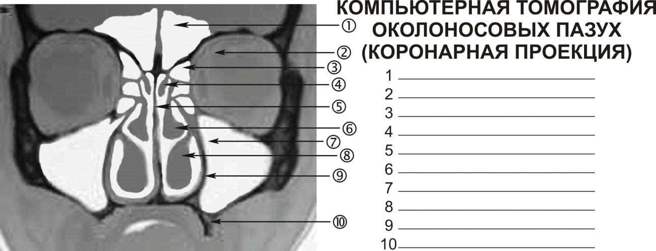 Акуметрия (Слуховой паспорт) - student2.ru