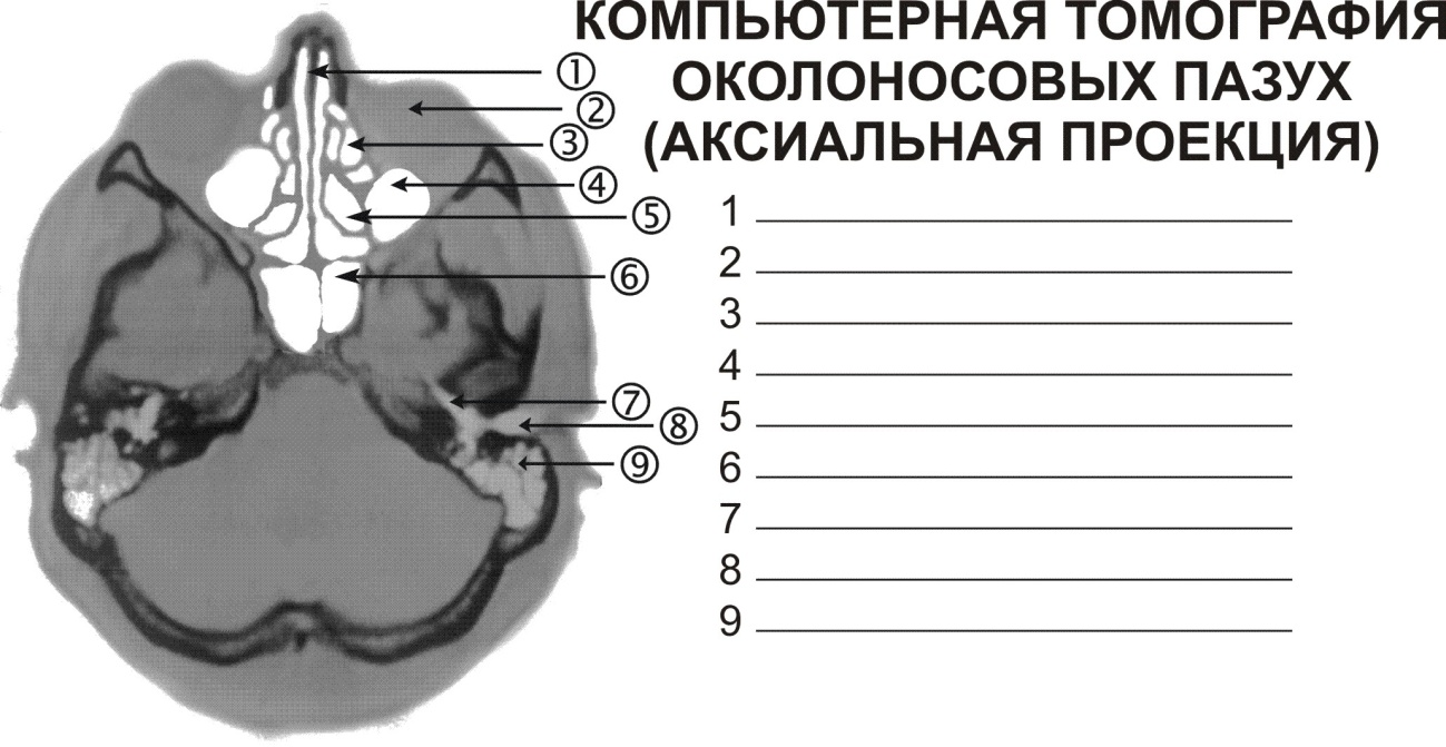Акуметрия (Слуховой паспорт) - student2.ru