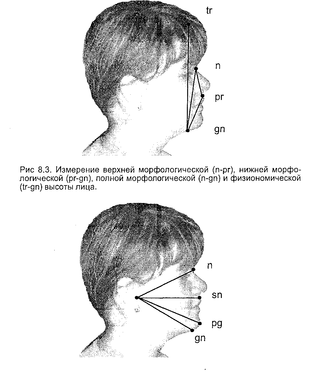 Антропометрические исследования лица и головы пациента - student2.ru