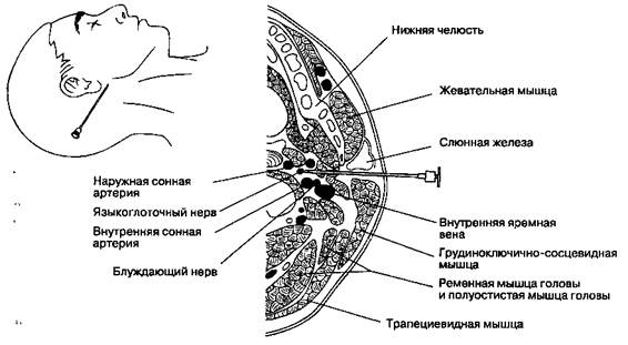 Блокада лицевого нерва - student2.ru