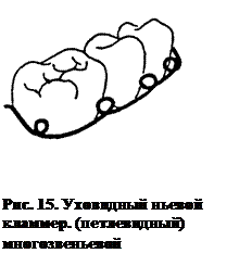 Фиксирующие элементы ортодонтических аппаратов - student2.ru