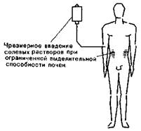 Гипертоническая гипергидратация - student2.ru