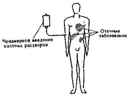 Гипертоническая гипергидратация - student2.ru