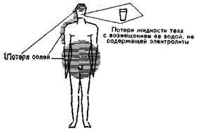Гипотоническая дегидратация (обезвоживание с дефицитом солей) - student2.ru