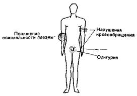 Гипотоническая дегидратация (обезвоживание с дефицитом солей) - student2.ru