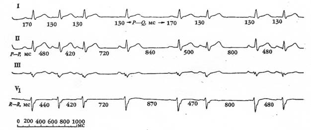 глава 1. этиология нарушений ритма сердца - student2.ru