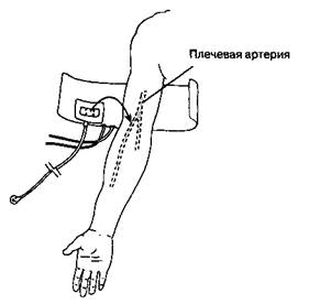 Глава 6 Интраоперационный мониторинг - student2.ru