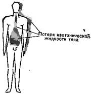 Изотоническая дегидратация - student2.ru