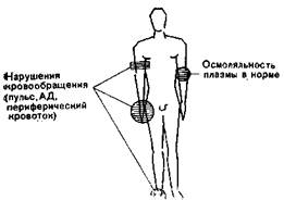 Изотоническая дегидратация - student2.ru