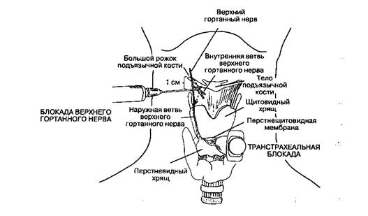 Какие альтернативные методики интубации могут быть использованы в этом случае? - student2.ru