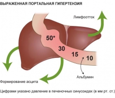 Классификация портальной гипертензии - student2.ru