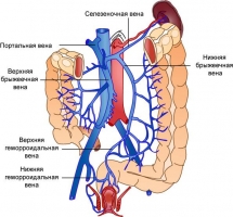 Классификация портальной гипертензии - student2.ru