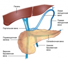 Классификация портальной гипертензии - student2.ru