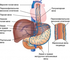 Классификация портальной гипертензии - student2.ru