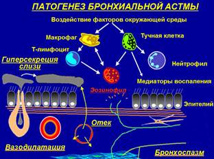 Классификация тяжести бронхиальной астмы по клиническим признакам (GINA, 2002) - student2.ru