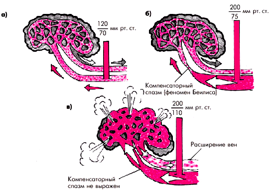 Классификация эссенциальной АГ (гипертонической болезни) (ВОЗ, 1996) - student2.ru