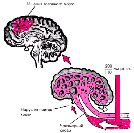 Классификация эссенциальной АГ (гипертонической болезни) (ВОЗ, 1996) - student2.ru
