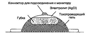 Клинические особенности. ЭКГ представляет собой запись электрических по­тенциалов - student2.ru