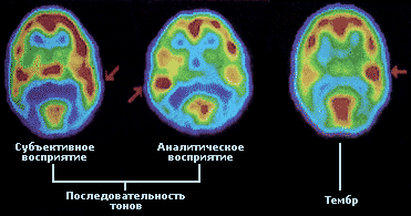 Компьютерная томография (КТ) - student2.ru