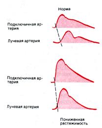 Лабораторная работа № 4.8. Исследовать свойства артериального пульса - student2.ru