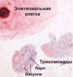 лабораторные методы диагностики паразитарных болезней - student2.ru